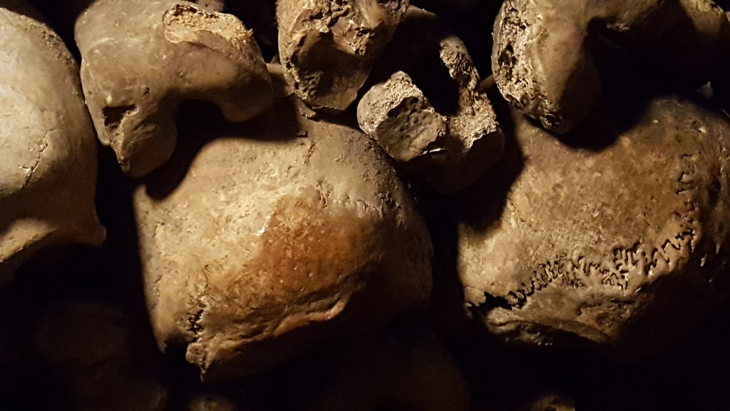 The Brown Mottling on the Skull to the Left of Center Indicates that the Poor Person to the Left of Center Died of the Plague